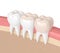 3d render of teeth with different types of filling