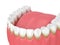 3d render of teeth with plaque and tartar