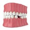 3d render of teeth sliding towards the area of missing tooth in order to fill the gap