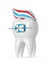 3d render of tooth with brace and toothpaste