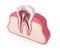 3d render of tooth with dental root canal posts