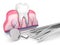 3d render of tooth in gums and dental diagnostic instruments over white