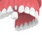 3d render of upper jaw with teeth and dental premolar crown