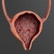 3D Render of Urinary Tract