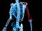 3d rendered medically accurate illustration of a skeleton with painful arm