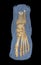 3D rendering  of the foot bones for diagnosis bone fracture and rheumatoid arthritis
