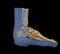 3D rendering  of the foot bones for diagnosis bone fracture and rheumatoid arthritis