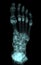 3D rendering  of the foot bones for diagnosis bone fracture and rheumatoid arthritis