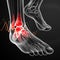 3D rendering illustration of ankle