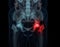 3D rendering Pelvic bone and hip joint 3D isolated on black background