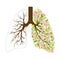 670_Human lungs. respiratory system. Healthy lungs