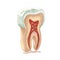72_tooth structure, graphics