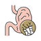 abdominal swelling mesothelioma color icon vector illustration
