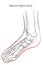 Abductor hallucis muscle foot.