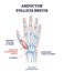 Abductor pollicis brevis muscle with hand and palm bones outline diagram