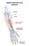 Abductor pollicis longus muscle with hand and arm skeleton outline diagram