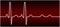 Abnormal EKG