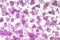 Abstract glitter pink hearts background