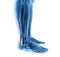 Achilles tendon with lower leg muscles