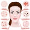 acne on the face. Types of skin diseases. Black dots.