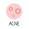Acne, pimple concept