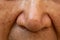 Acne, Small pimple is on senior woman nose, Deep groove cheeks, Close up and macro shot, Selective focus, Asian Body skin part,