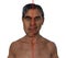 Acromegaly in a man, and the same healthy person, 3D illustration