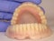 Acrylic dental prosthesis with metal retaining base