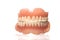 ACRYLIC DENTURE- FULL FRONT SET