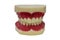 Acrylic denture set