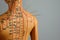 Acupuncture - alternative medicine. Human model with needles in shoulder against grey background, space for text