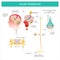 Acute Headache. Diagram learning The Acute Headache as a result a process of the brain and consequences expanded the blood vessel