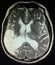 Acute infarction brain mri examination stroke