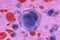 Acute myeloid leukemia AML cells in blood flow - closeup view 3d illustration