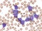 Acute myeloid leukemia. peripheral blood.