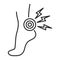 Acute pain foot black line icon. Sprain, injury. Isolated vector element. Outline pictogram for web page, mobile app, promo