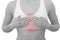 Acute pain in a woman chest