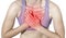 Acute pain in a woman chest