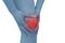 Acute pain in a woman knee