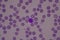 Adequate of platelet in blood smear