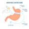 Adjustable gastric band bariatric surgery weight loss infographics