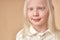 Adorable albino girl 7-9 years old isolated