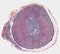 Adrenal gland cross section