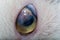 Adult cat with corneal ulcer