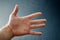 Adult hand with Raynaud`s Syndrome - Phenomenon. Close up hand with fingers on dark background with copy space