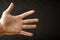 Adult hand with Raynaud`s Syndrome - Phenomenon. Close up hand with fingers on dark background with copy space