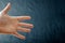 Adult hand with Raynaud`s Syndrome - Phenomenon. Close up hand with fingers on dark background with copy space