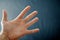 Adult hand with Raynaud`s Syndrome - Phenomenon. Close up hand with fingers on dark background with copy space