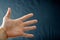 Adult hand with Raynaud`s Syndrome - Phenomenon. Close up hand with fingers on dark background with copy space