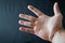 Adult hand with Raynaud`s Syndrome - Phenomenon. Close up hand with fingers on dark background with copy space